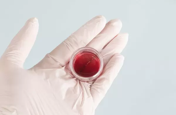 Test tube with blood sample