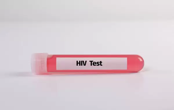 Test tube with HIV Test text