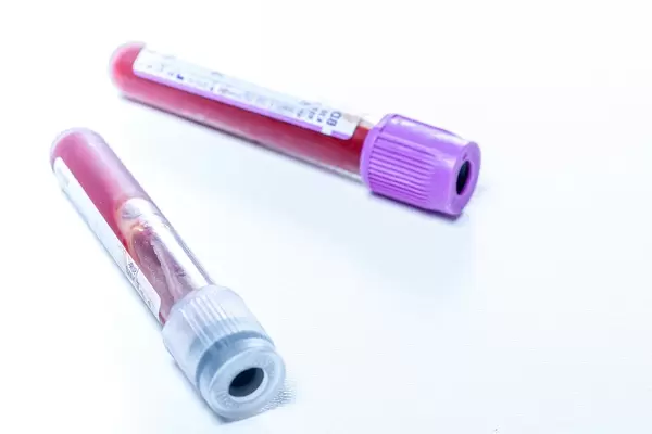 Test tubes with blood in laboratory on white background (Flip 2019)