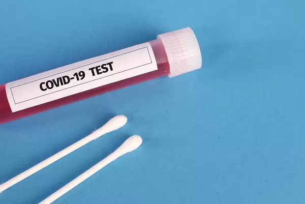 Tube with blood samples for Coronavirus test blue background