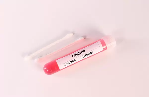 Tube with blood samples for Coronavirus test