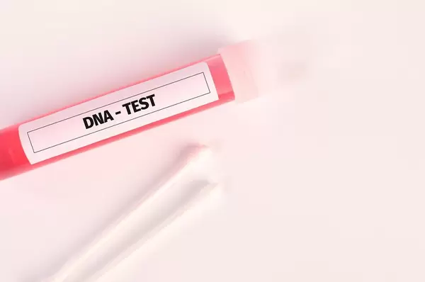 Tube with blood samples for DNA test
