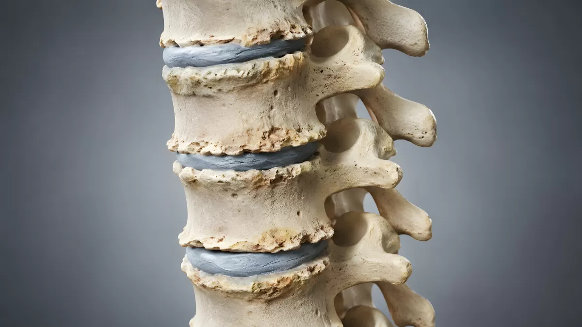 Wirbelsäule mit Bandscheiben – anatomisches Modell