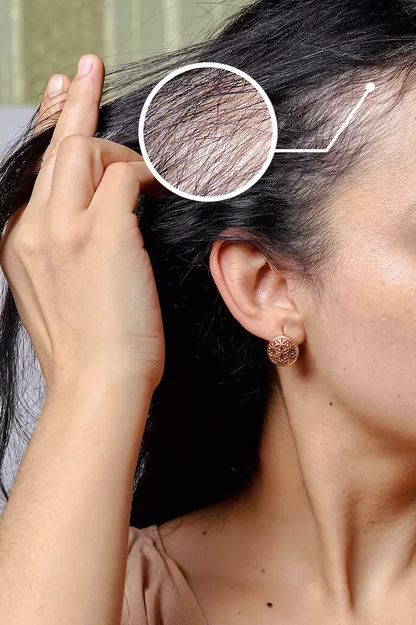 Woman with problematic hair. Female hair loss