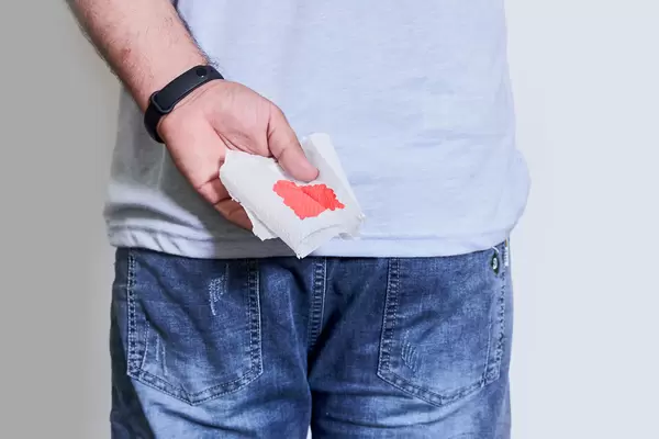 Young male hand holds a piece of toilet paper with blood from hemorrhoids