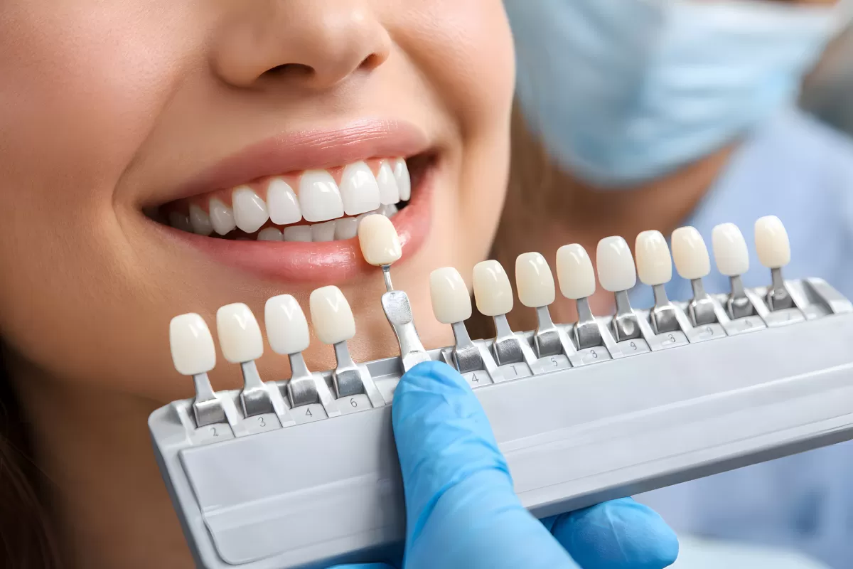 Zahnarzt vergleicht Zahnfarben mit Farbpalette