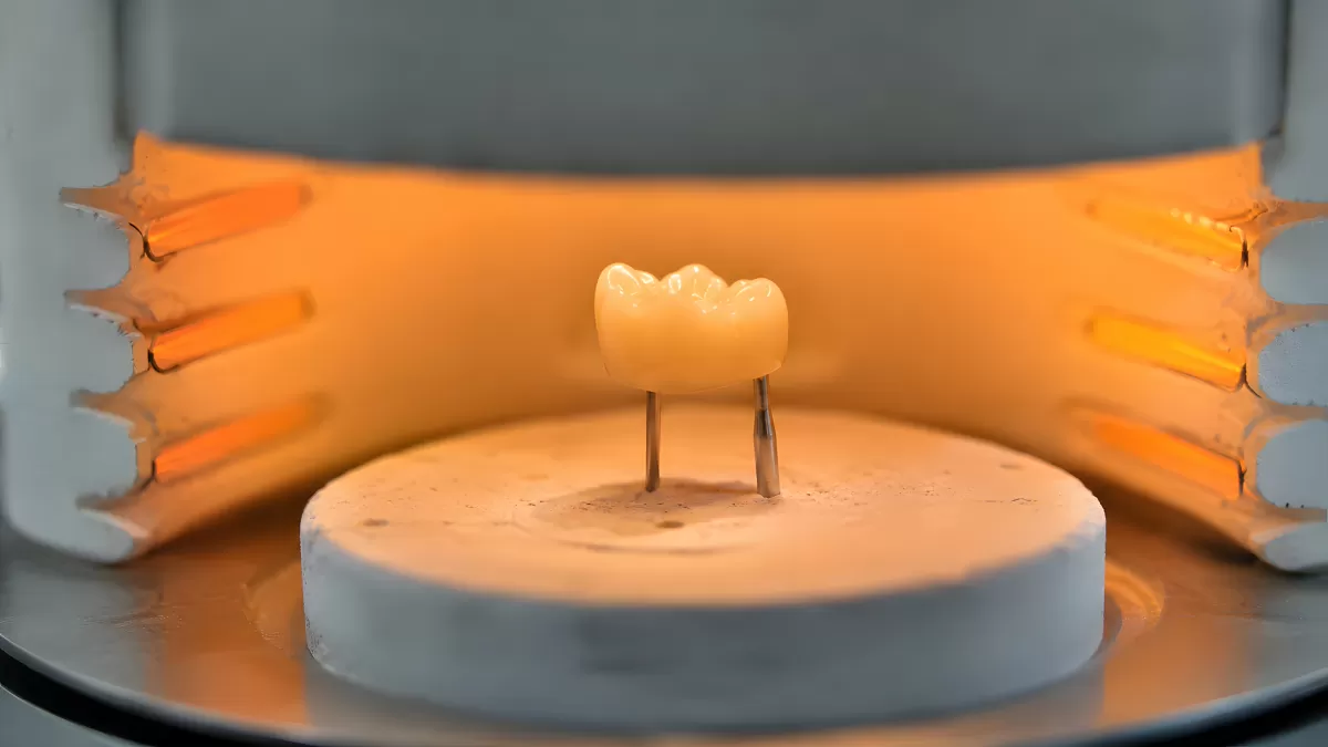 Zahnkrone im Dentalofen beim Brennvorgang