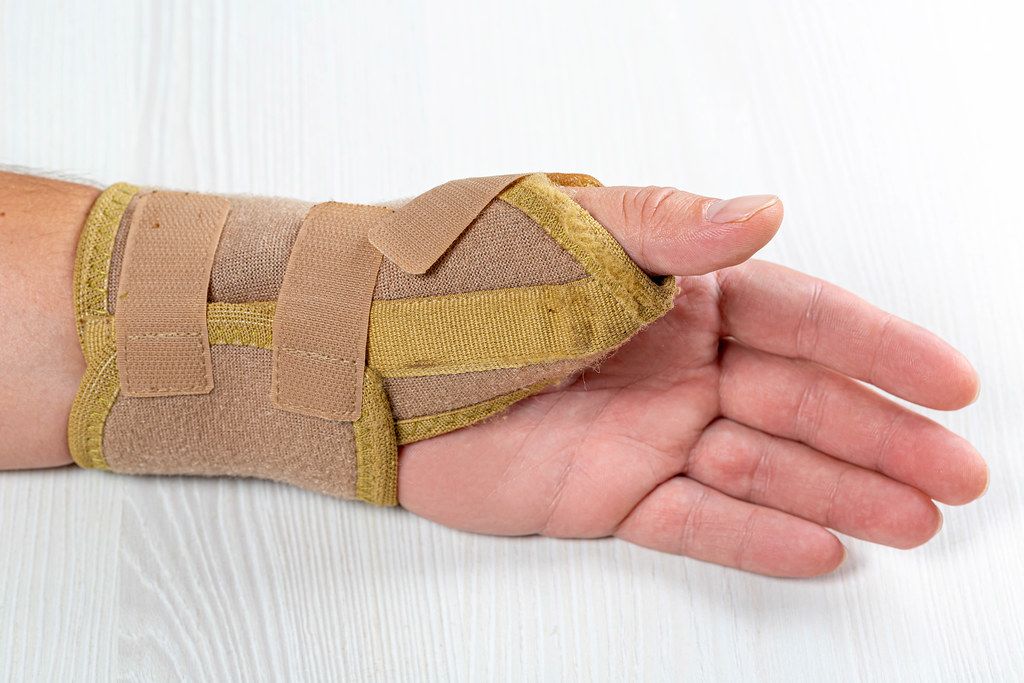 Bandage on the wrist of a man with a bruised hand
