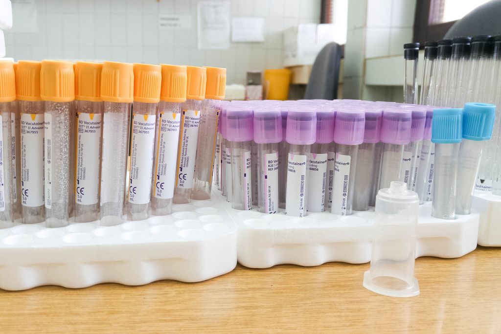 Close-up shot of test tubes at a medical lab