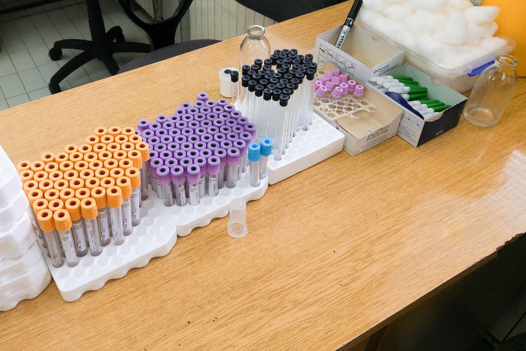 Different kinds of test tubes at a medical laboratory