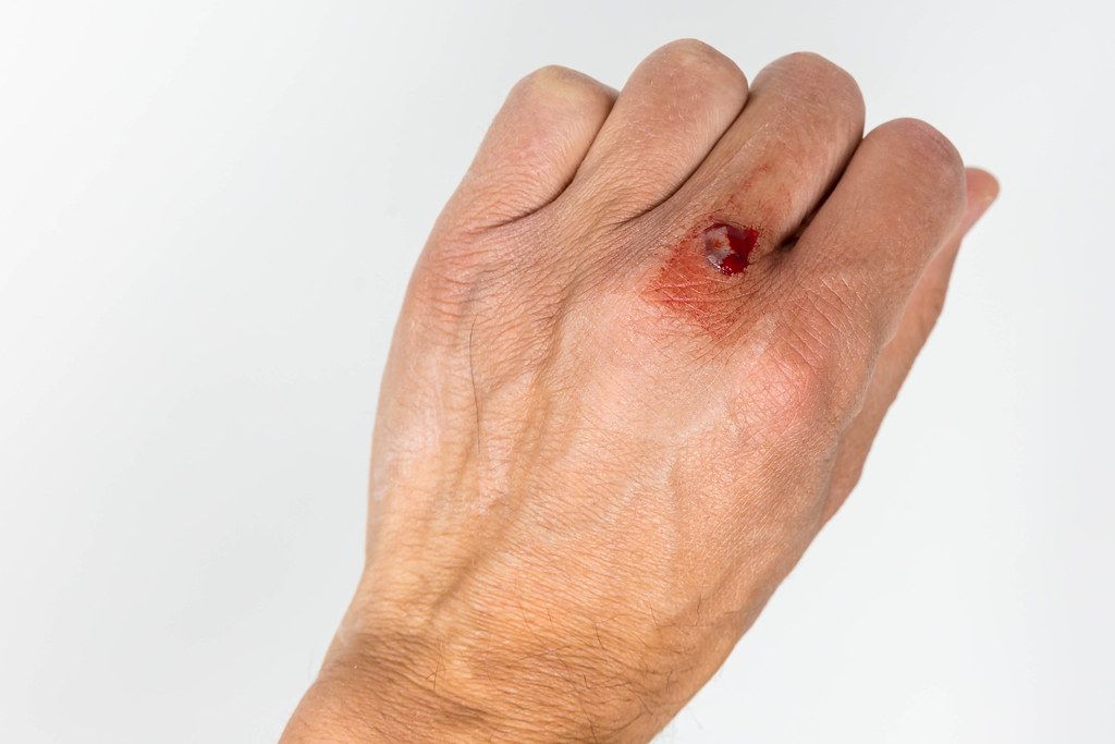 Hand of a man with a small bleeding wound on a white background