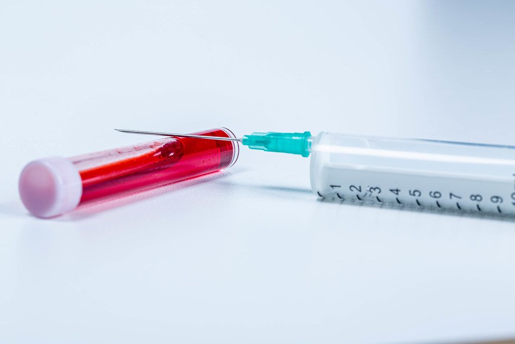Syringe and plastic test tube with blood