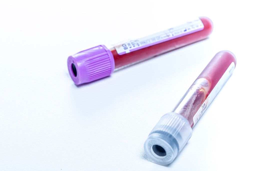 Test tubes with blood in laboratory on white background