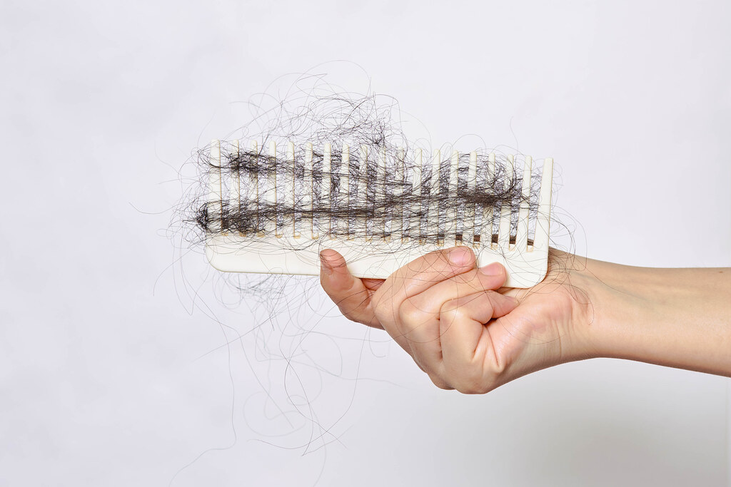 Balding problem women hand holding loss hair comb.