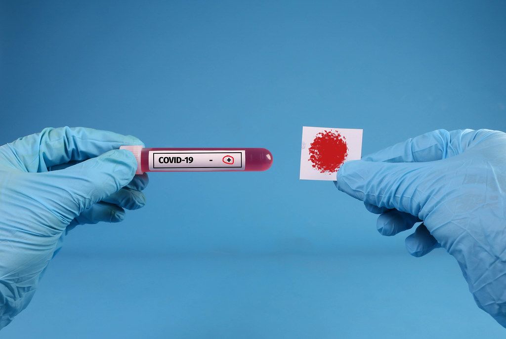 Doctor hands analyzing Coronavirus COVID 19 test blood