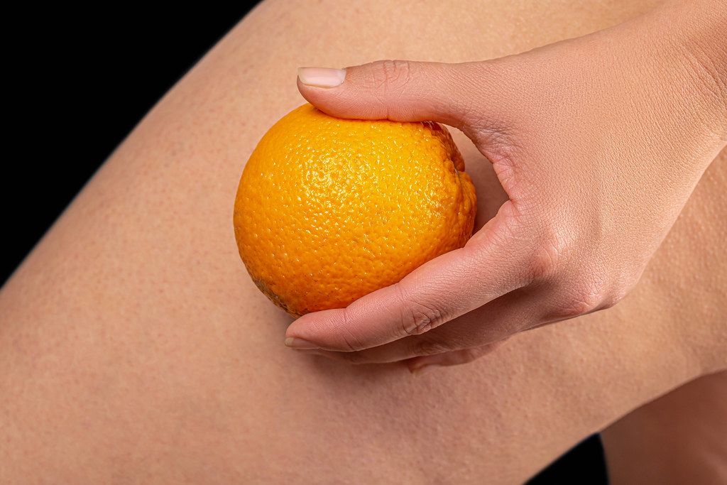 Female thigh and orange in the hand. The concept of skin care, the fight against cellulite