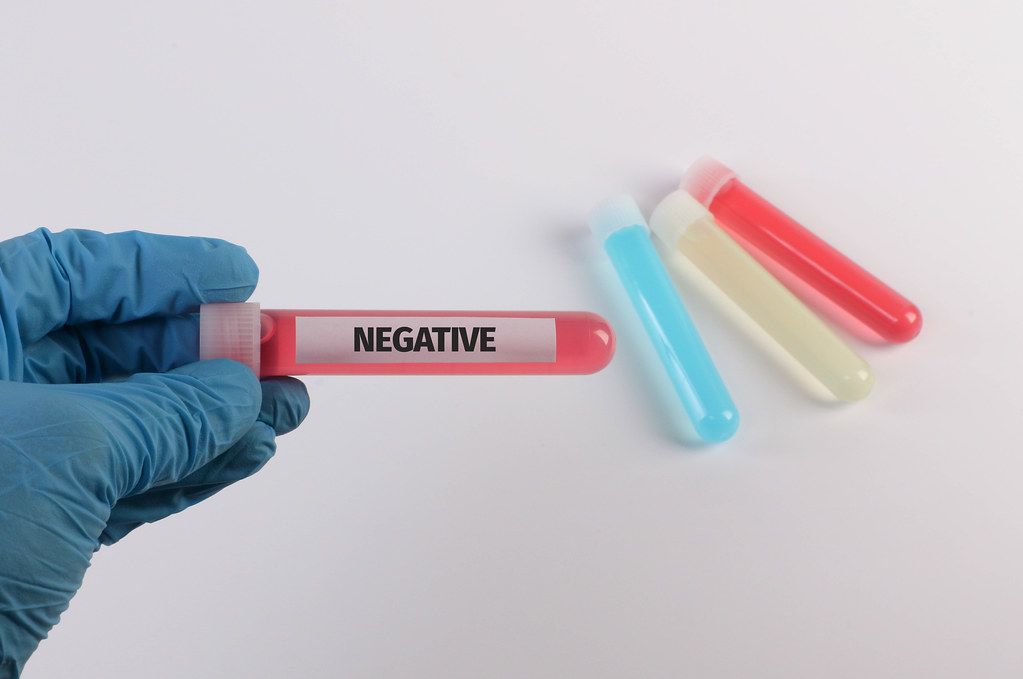 Hands in medical gloves holding test tube with Negative text
