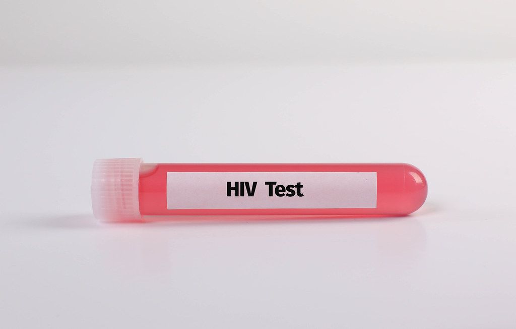 Test tube with HIV Test text