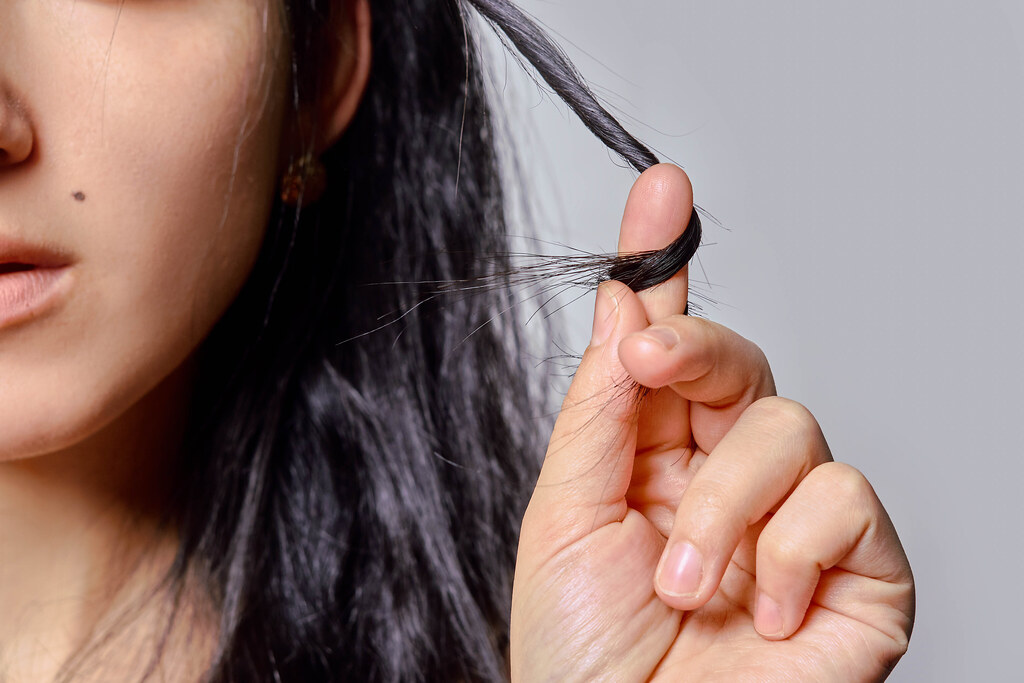 Thinning hair and hair loss in women
