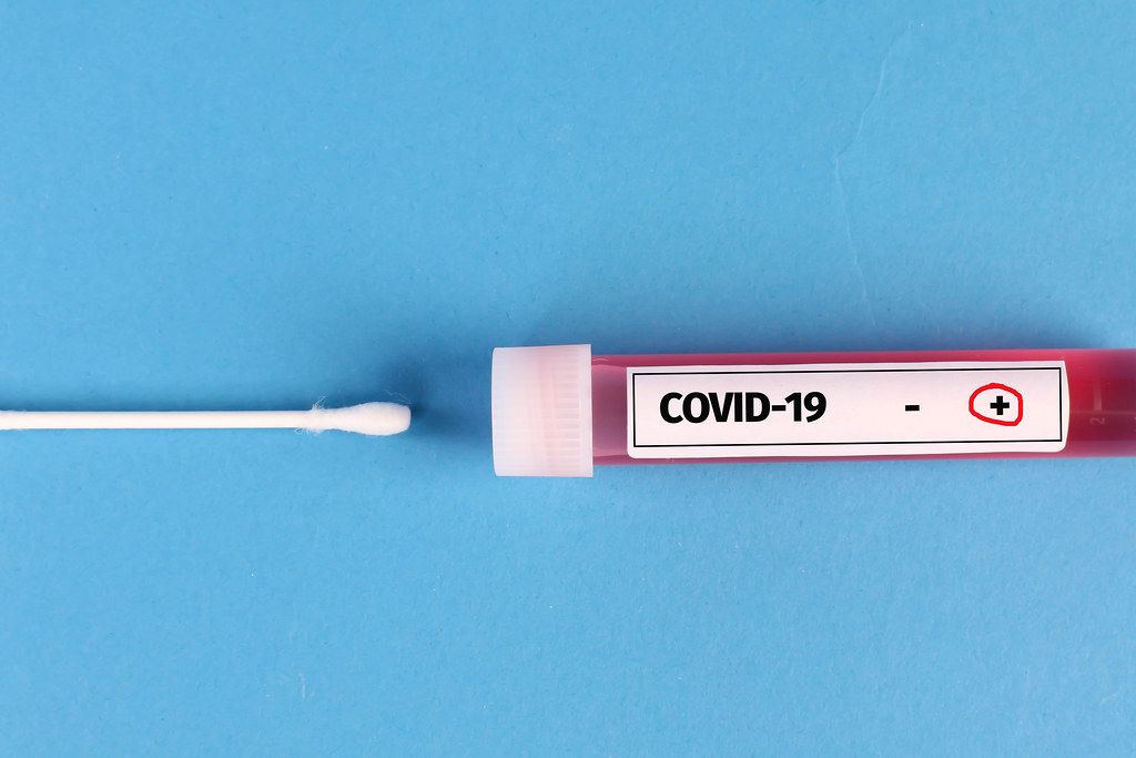 Tube with positive blood samples for Coronavirus test on blue background