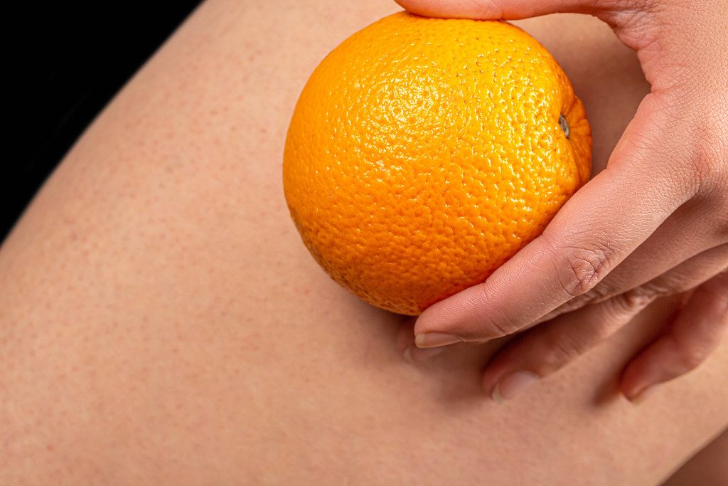 Woman holds an orange in her hand near her legs. The concept of cellulite on the body