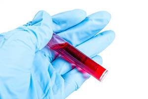 A plastic tube with blood in the hand. Concept of diagnostic tests
