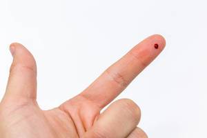 Bluttropfen auf einem Finger nach Einstich mit Nadel