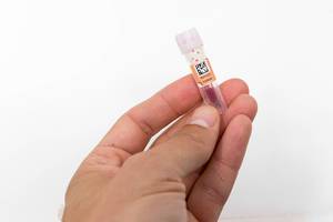 Corona Antikörper Test: Hand hält die entnommene Blutprobe, die ans Labor versandt wird