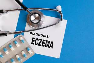 Diagnosis Eczema written on medical blue folder
