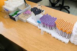 Different kinds of test tubes at a medical laboratory  Flip 2019