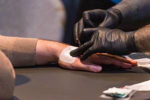 Digitalisierung geht unter die Haut: Implantieren eines NFC Chips zwischen Zeigefinger und Daumen
