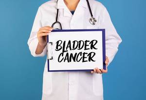 Doctor holding clipboard with Bladder Cancer text