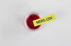 Draufsicht einer Blutprobe in einem Gefäß mit den Worten Mers-CoV auf einem Zettel