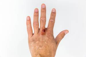Kleine Verletzung: Hand von Mann mit Wunde vor weißem Hintergrund