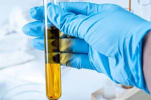 Laboratory test tube with orange solution in hand (Flip 2020)