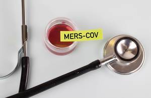 Mers-CoV Blutprobe und ein Stethoskop auf einem weißem Tisch
