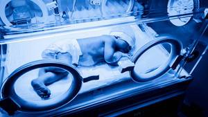 Newborn baby in an incubator machine receiving phototherapy for neonatal jaundice  Flip 2019