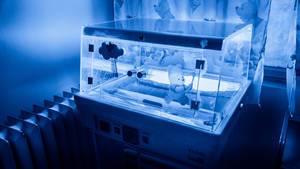 Phototherapy unit for neonatal jaundice at a hospital  Flip 2019