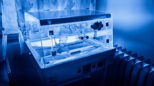Phototherapy unit for neonatal jaundice at a hospital