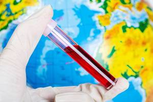 Test tube with blood in a hand on a background of the globe